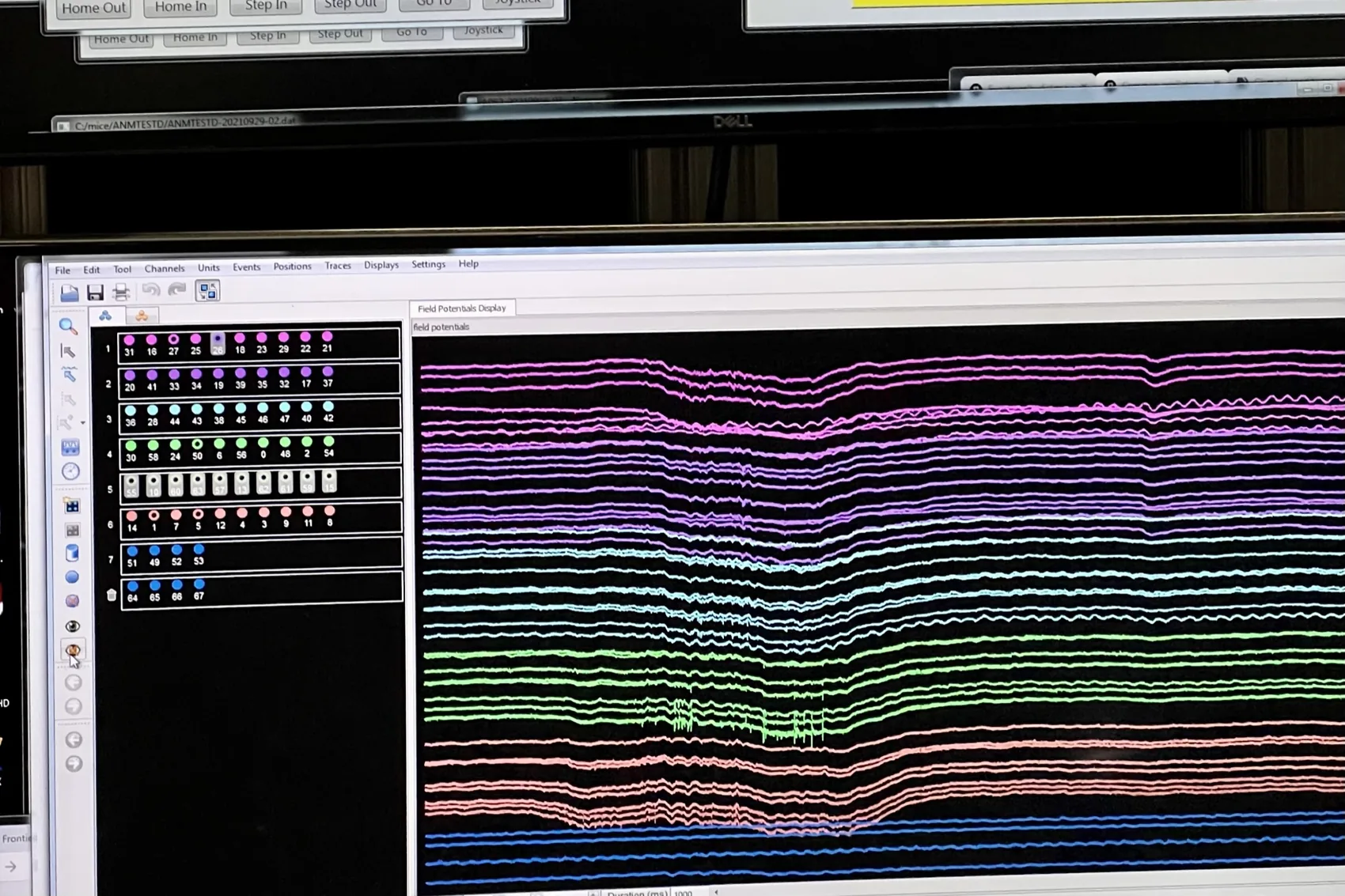 Monitor showing multichannel local field potential traces from a first LFP recording session.