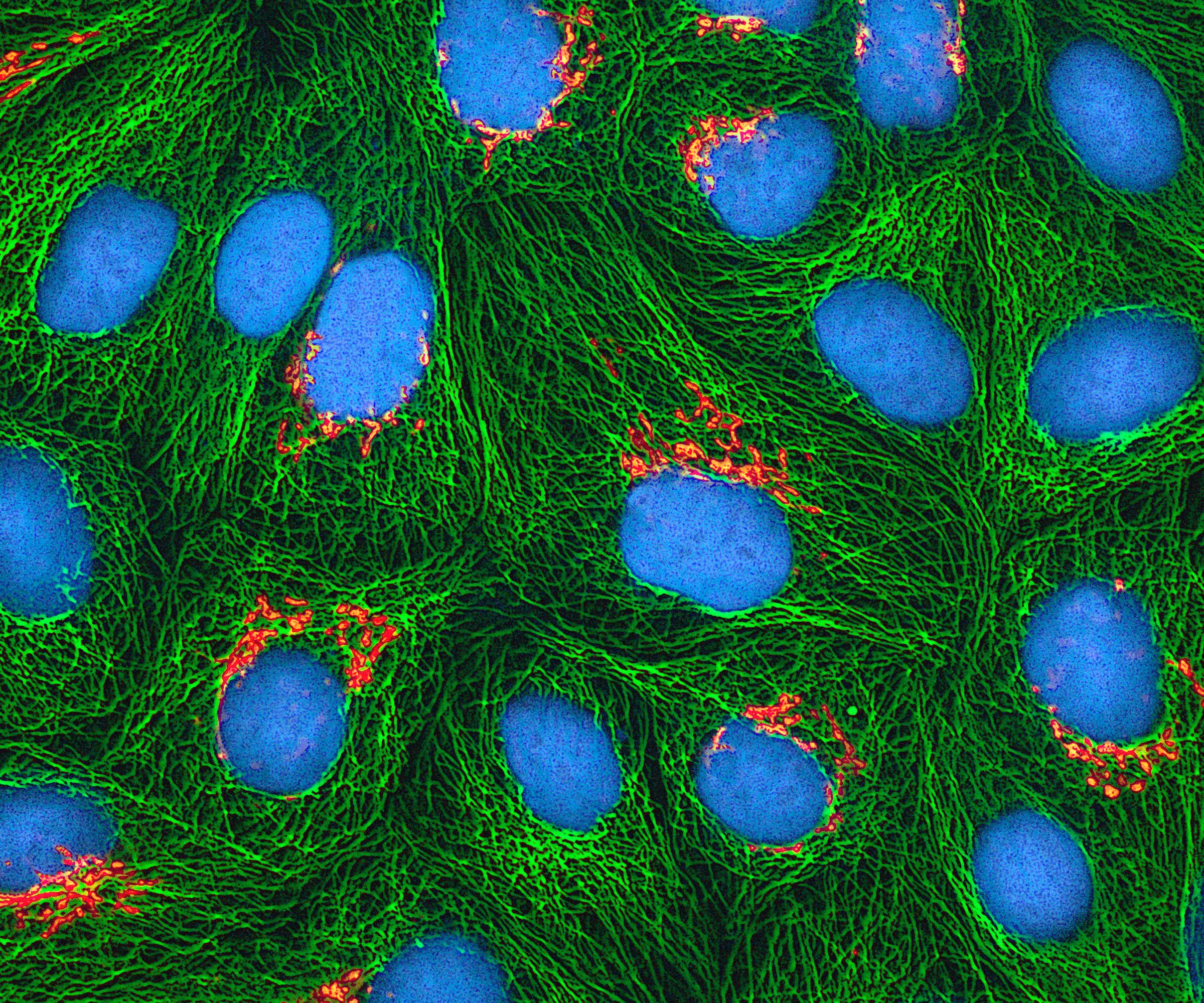 Multiphoton fluorescence image of HeLa cells showing Golgi apparatus in orange, microtubules in green, and DNA in cyan